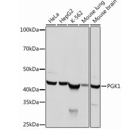 Western Blot - Anti-PGK1 Antibody [ARC0700] (A307800) - Antibodies.com