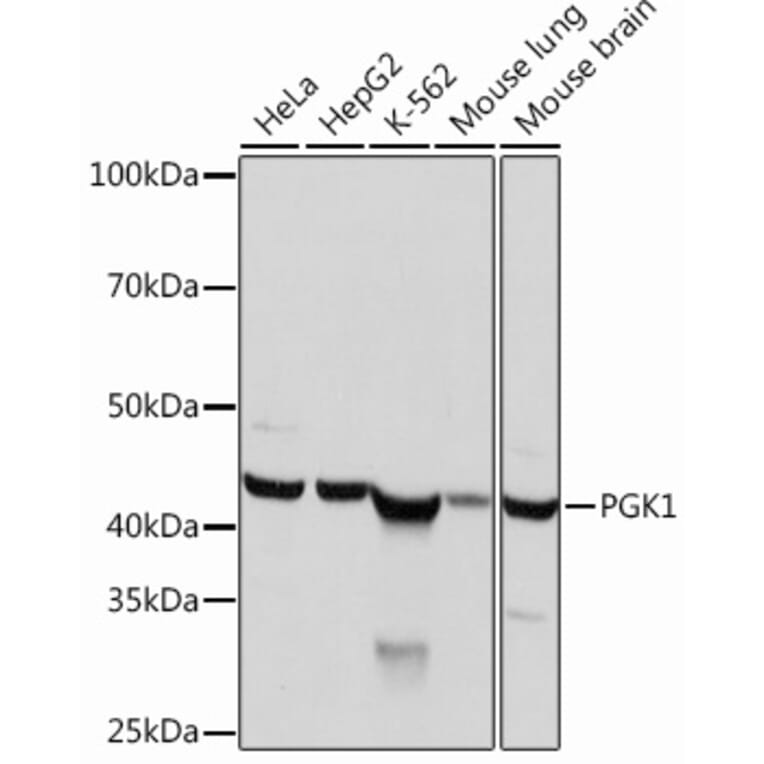 Western Blot - Anti-PGK1 Antibody [ARC0700] (A307800) - Antibodies.com