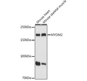 Western Blot - Anti-MYOM2 Antibody (A307801) - Antibodies.com