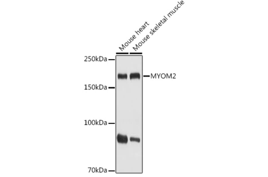 Western Blot - Anti-MYOM2 Antibody (A307801) - Antibodies.com