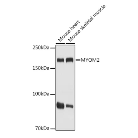 Western Blot - Anti-MYOM2 Antibody (A307801) - Antibodies.com