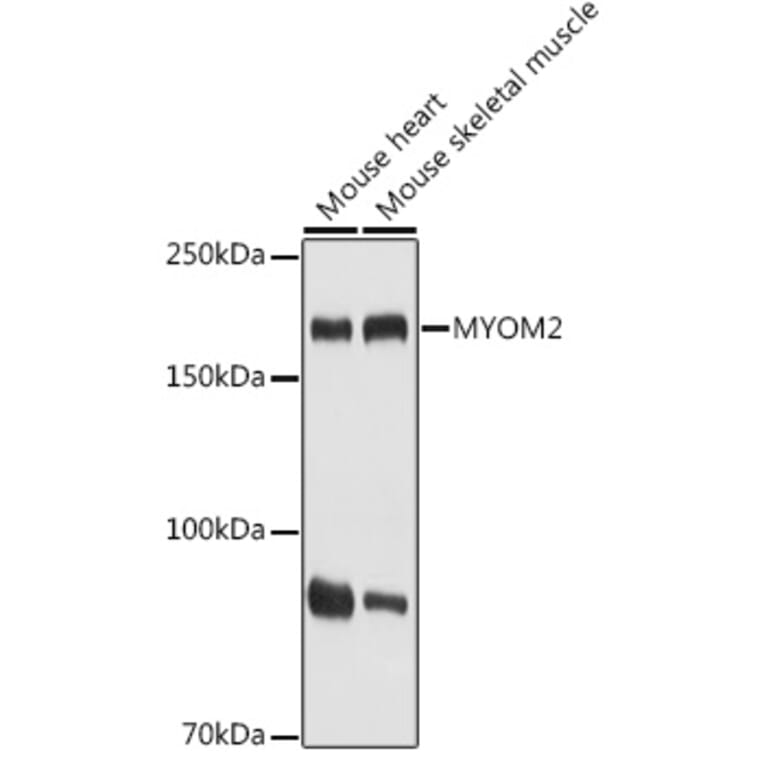Western Blot - Anti-MYOM2 Antibody (A307801) - Antibodies.com