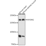 Western Blot - Anti-MYOM2 Antibody (A307801) - Antibodies.com