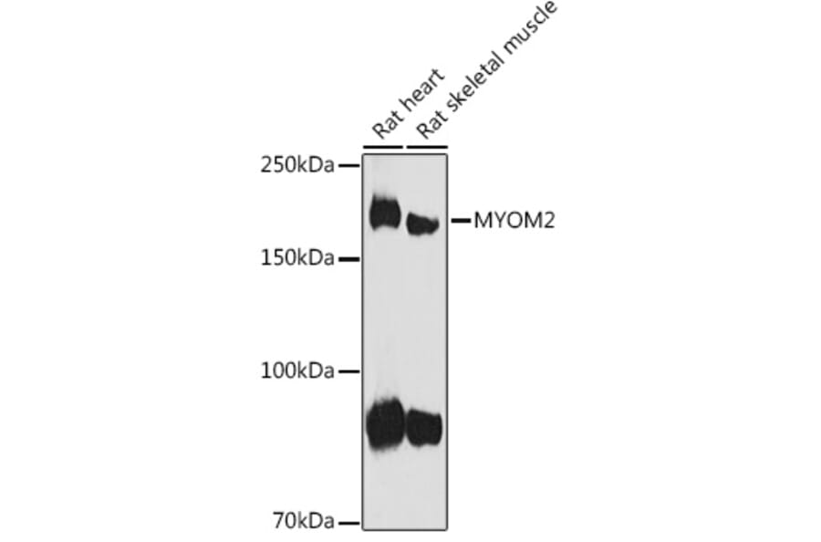 Western Blot - Anti-MYOM2 Antibody (A307801) - Antibodies.com