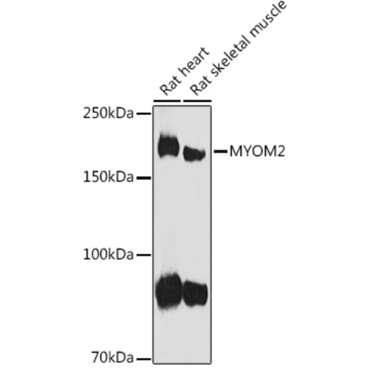 Western Blot - Anti-MYOM2 Antibody (A307801) - Antibodies.com