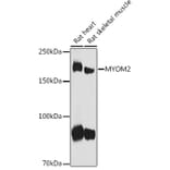 Western Blot - Anti-MYOM2 Antibody (A307801) - Antibodies.com