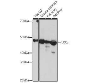 Western Blot - Anti-LXR alpha Antibody [ARC0877] (A307802) - Antibodies.com