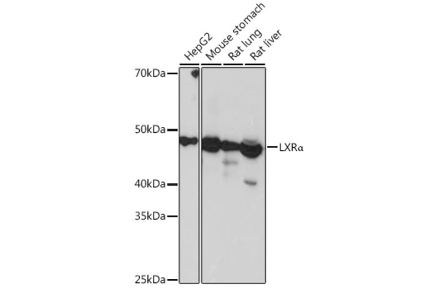 Western Blot - Anti-LXR alpha Antibody [ARC0877] (A307802) - Antibodies.com