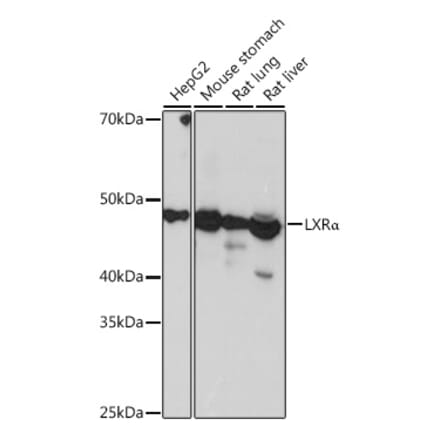 Western Blot - Anti-LXR alpha Antibody [ARC0877] (A307802) - Antibodies.com
