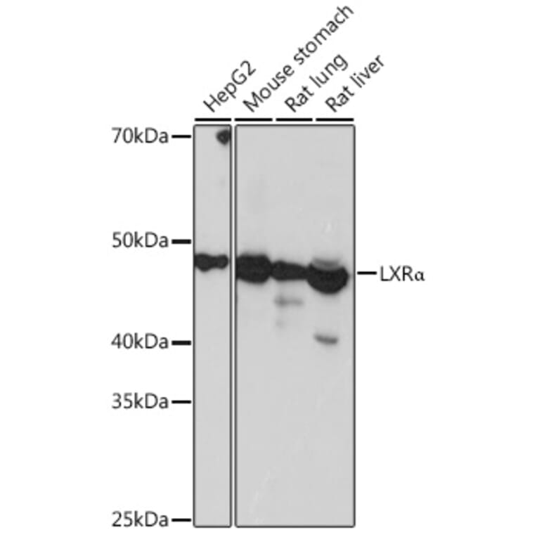 Western Blot - Anti-LXR alpha Antibody [ARC0877] (A307802) - Antibodies.com