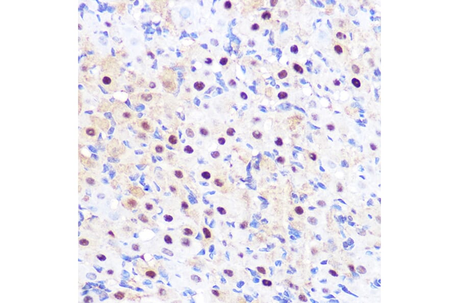 Immunohistochemistry - Anti-LXR alpha Antibody [ARC0877] (A307802) - Antibodies.com