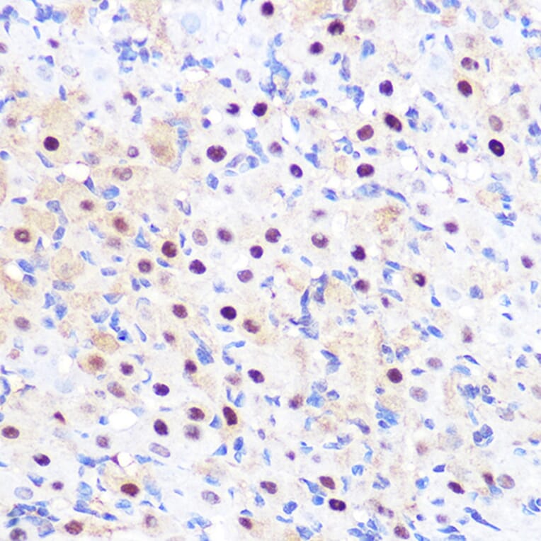 Immunohistochemistry - Anti-LXR alpha Antibody [ARC0877] (A307802) - Antibodies.com