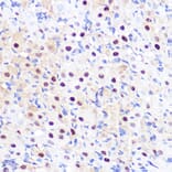 Immunohistochemistry - Anti-LXR alpha Antibody [ARC0877] (A307802) - Antibodies.com