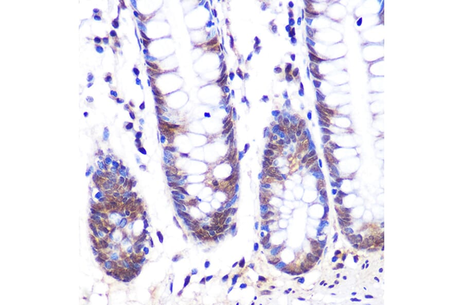 Immunohistochemistry - Anti-LXR alpha Antibody [ARC0877] (A307802) - Antibodies.com