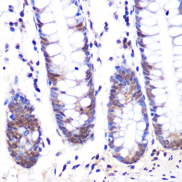 Immunohistochemistry - Anti-LXR alpha Antibody [ARC0877] (A307802) - Antibodies.com