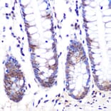 Immunohistochemistry - Anti-LXR alpha Antibody [ARC0877] (A307802) - Antibodies.com