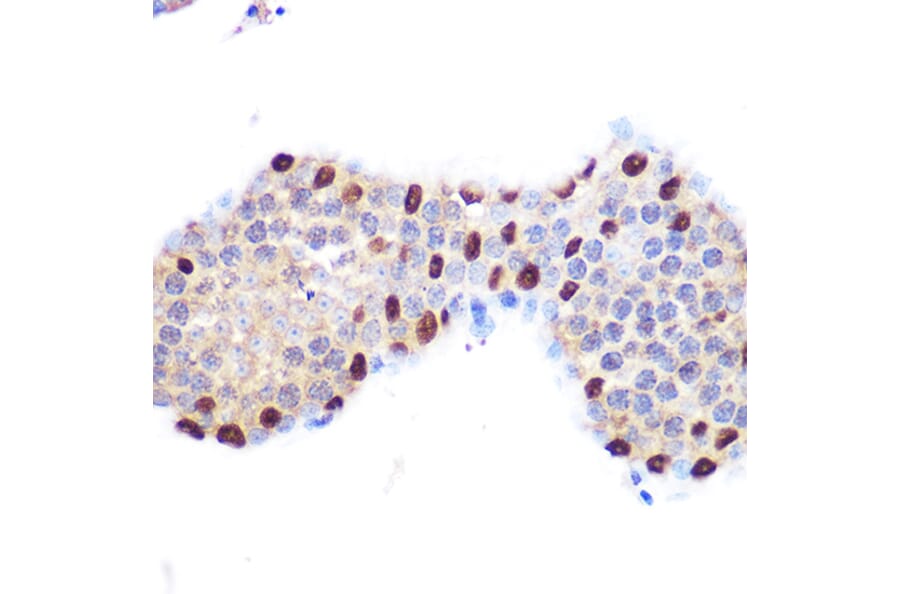 Immunohistochemistry - Anti-LXR alpha Antibody [ARC0877] (A307802) - Antibodies.com