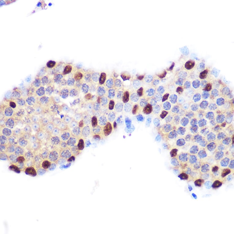 Immunohistochemistry - Anti-LXR alpha Antibody [ARC0877] (A307802) - Antibodies.com
