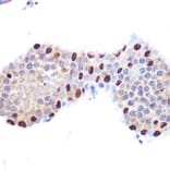 Immunohistochemistry - Anti-LXR alpha Antibody [ARC0877] (A307802) - Antibodies.com