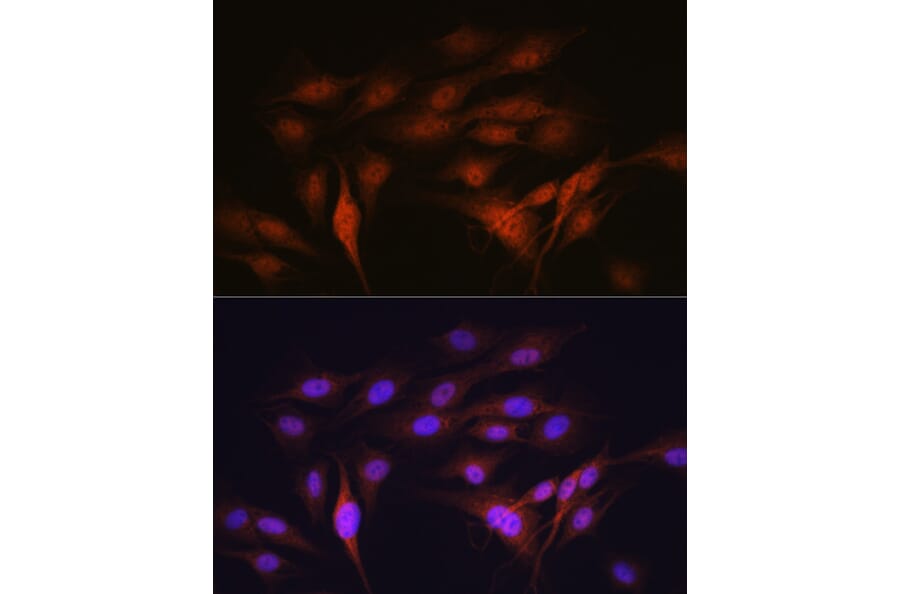Immunofluorescence - Anti-LXR alpha Antibody [ARC0877] (A307802) - Antibodies.com