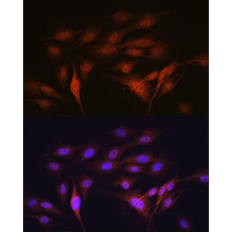 Immunofluorescence - Anti-LXR alpha Antibody [ARC0877] (A307802) - Antibodies.com