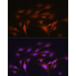Immunofluorescence - Anti-LXR alpha Antibody [ARC0877] (A307802) - Antibodies.com