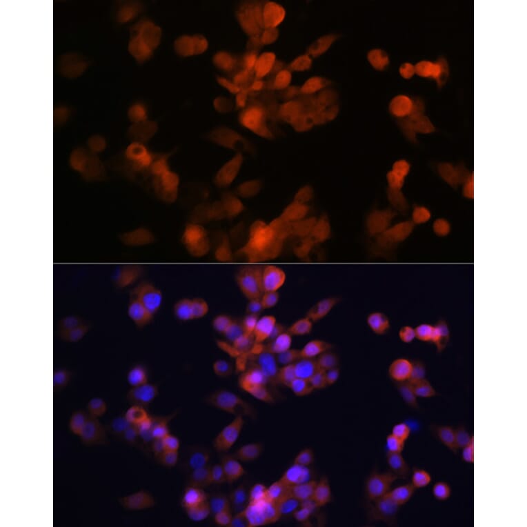 Immunofluorescence - Anti-LXR alpha Antibody [ARC0877] (A307802) - Antibodies.com