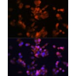Immunofluorescence - Anti-LXR alpha Antibody [ARC0877] (A307802) - Antibodies.com
