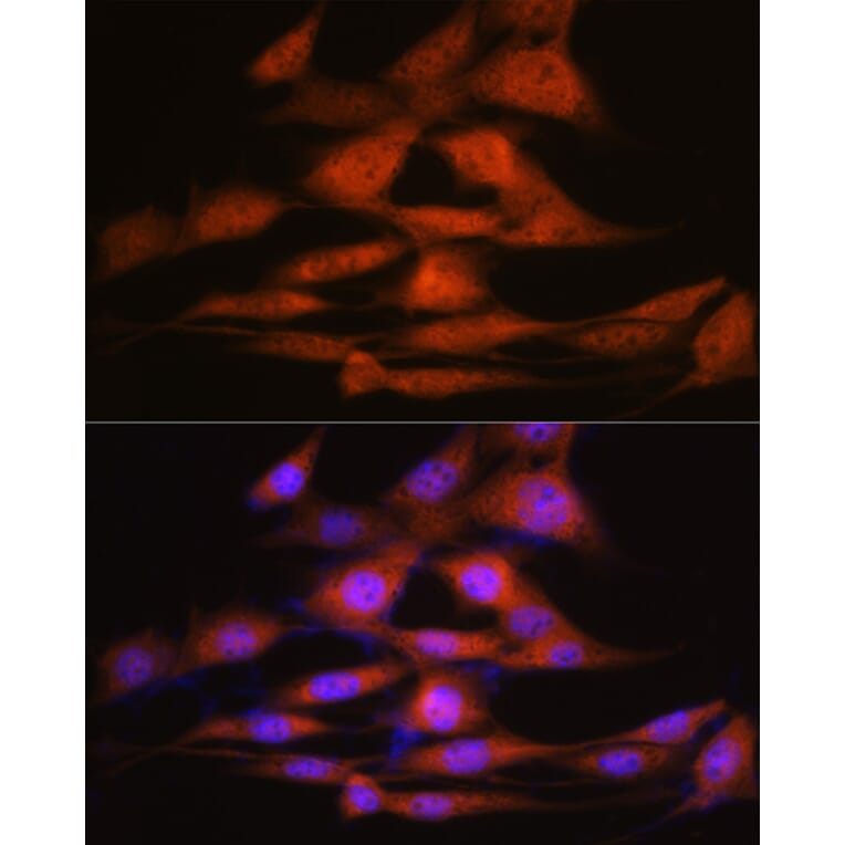 Immunofluorescence - Anti-LXR alpha Antibody [ARC0877] (A307802) - Antibodies.com
