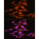 Immunofluorescence - Anti-LXR alpha Antibody [ARC0877] (A307802) - Antibodies.com