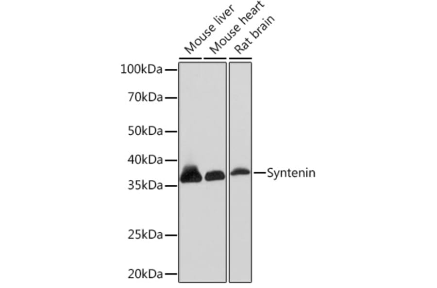 Western Blot - Anti-Syntenin Antibody [ARC1410] (A307803) - Antibodies.com