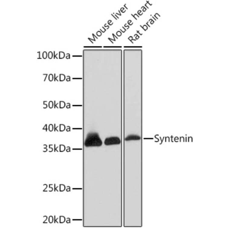 Western Blot - Anti-Syntenin Antibody [ARC1410] (A307803) - Antibodies.com