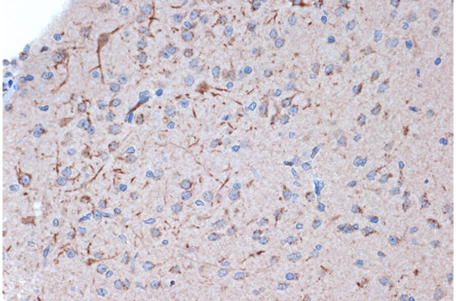 Immunohistochemistry - Anti-Syntenin Antibody [ARC1410] (A307803) - Antibodies.com