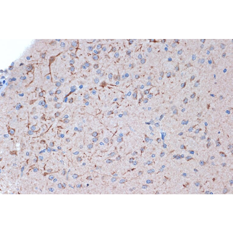 Immunohistochemistry - Anti-Syntenin Antibody [ARC1410] (A307803) - Antibodies.com