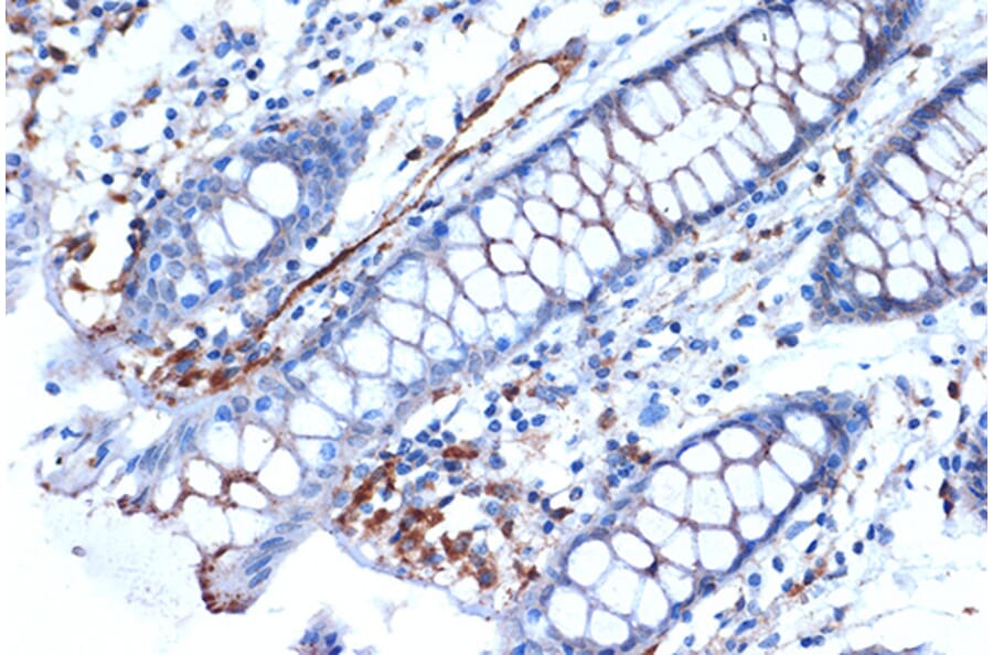 Immunohistochemistry - Anti-Syntenin Antibody [ARC1410] (A307803) - Antibodies.com