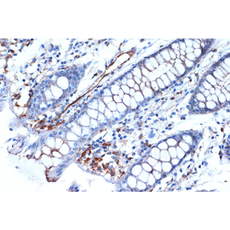 Immunohistochemistry - Anti-Syntenin Antibody [ARC1410] (A307803) - Antibodies.com