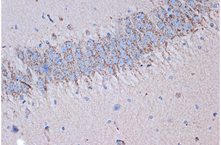 Immunohistochemistry - Anti-Syntenin Antibody [ARC1410] (A307803) - Antibodies.com