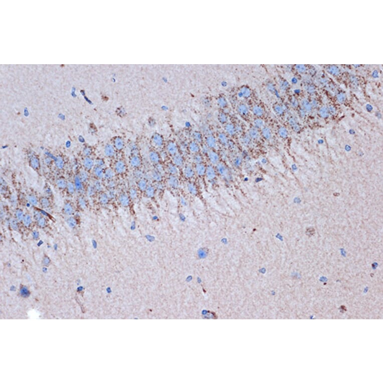Immunohistochemistry - Anti-Syntenin Antibody [ARC1410] (A307803) - Antibodies.com