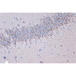 Immunohistochemistry - Anti-Syntenin Antibody [ARC1410] (A307803) - Antibodies.com