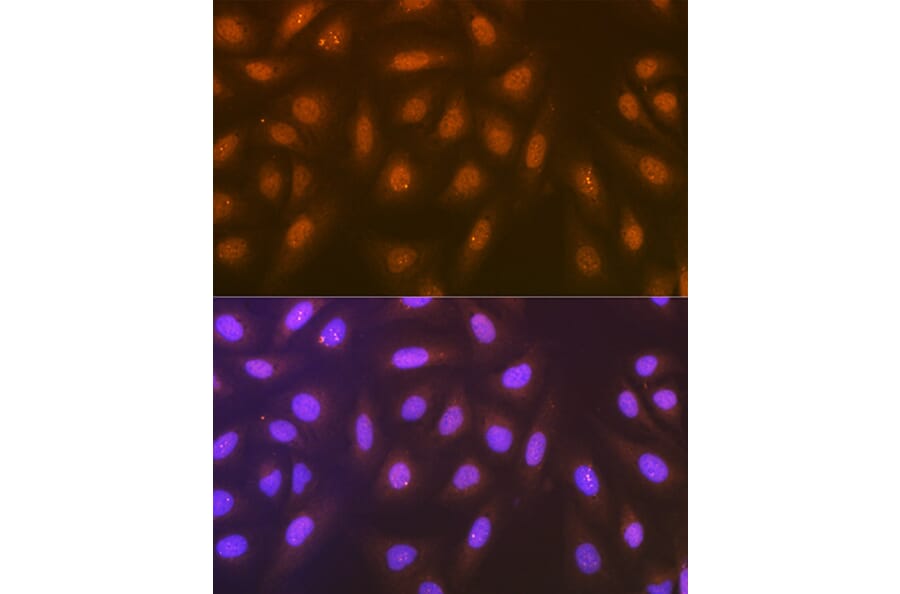 Immunofluorescence - Anti-Syntenin Antibody [ARC1410] (A307803) - Antibodies.com