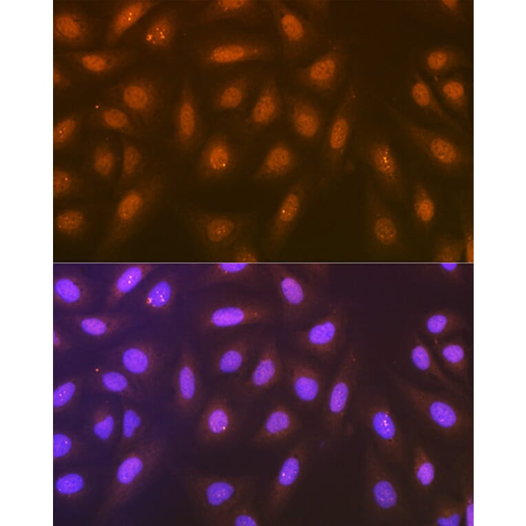 Immunofluorescence - Anti-Syntenin Antibody [ARC1410] (A307803) - Antibodies.com