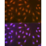 Immunofluorescence - Anti-Syntenin Antibody [ARC1410] (A307803) - Antibodies.com