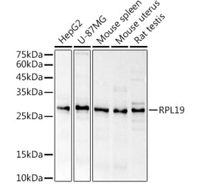 Western Blot - Anti-RPL19 Antibody (A307804) - Antibodies.com