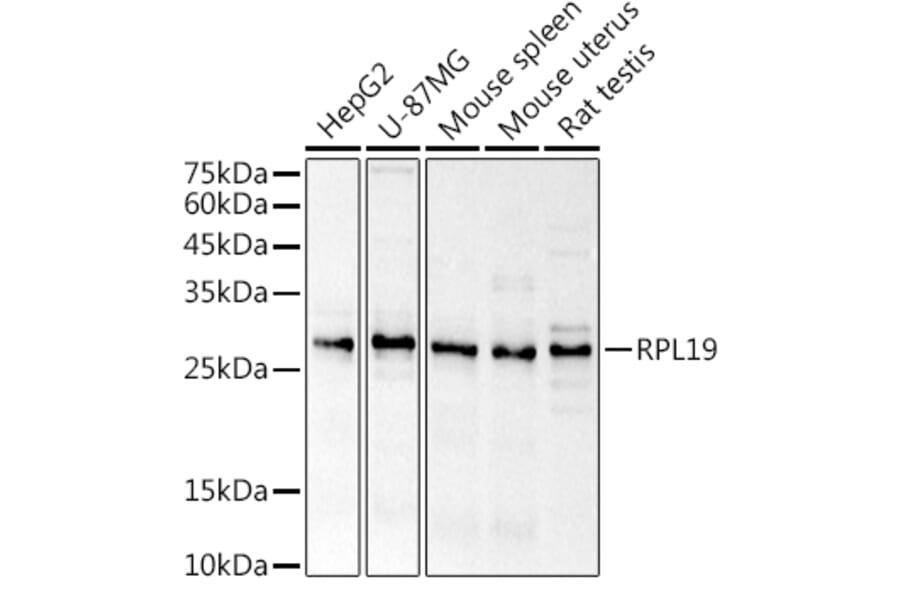 Western Blot - Anti-RPL19 Antibody (A307804) - Antibodies.com