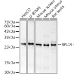 Western Blot - Anti-RPL19 Antibody (A307804) - Antibodies.com