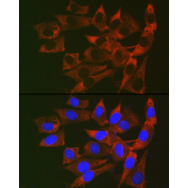 Immunofluorescence - Anti-RPL19 Antibody (A307804) - Antibodies.com