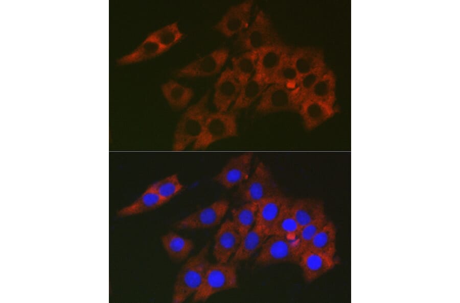 Immunofluorescence - Anti-RPL19 Antibody (A307804) - Antibodies.com