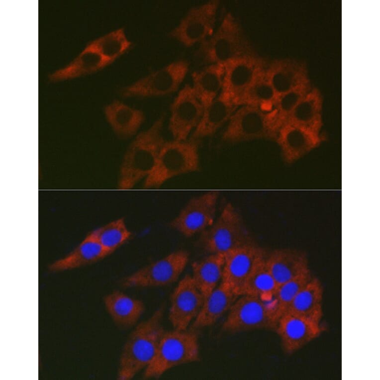 Immunofluorescence - Anti-RPL19 Antibody (A307804) - Antibodies.com