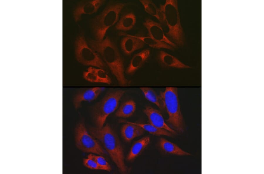 Immunofluorescence - Anti-RPL19 Antibody (A307804) - Antibodies.com