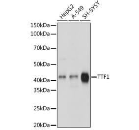 Western Blot - Anti-TTF1 Antibody [ARC1942] (A307805) - Antibodies.com